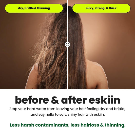 Eskiin Filtered Shower Head - Best HandHeld Shower Head With Filters For Healthy Hair & Skin - High Pressure - Reduce Dandruff, Protect Colored Hair, And Soothe Dry Skin (Chrome)